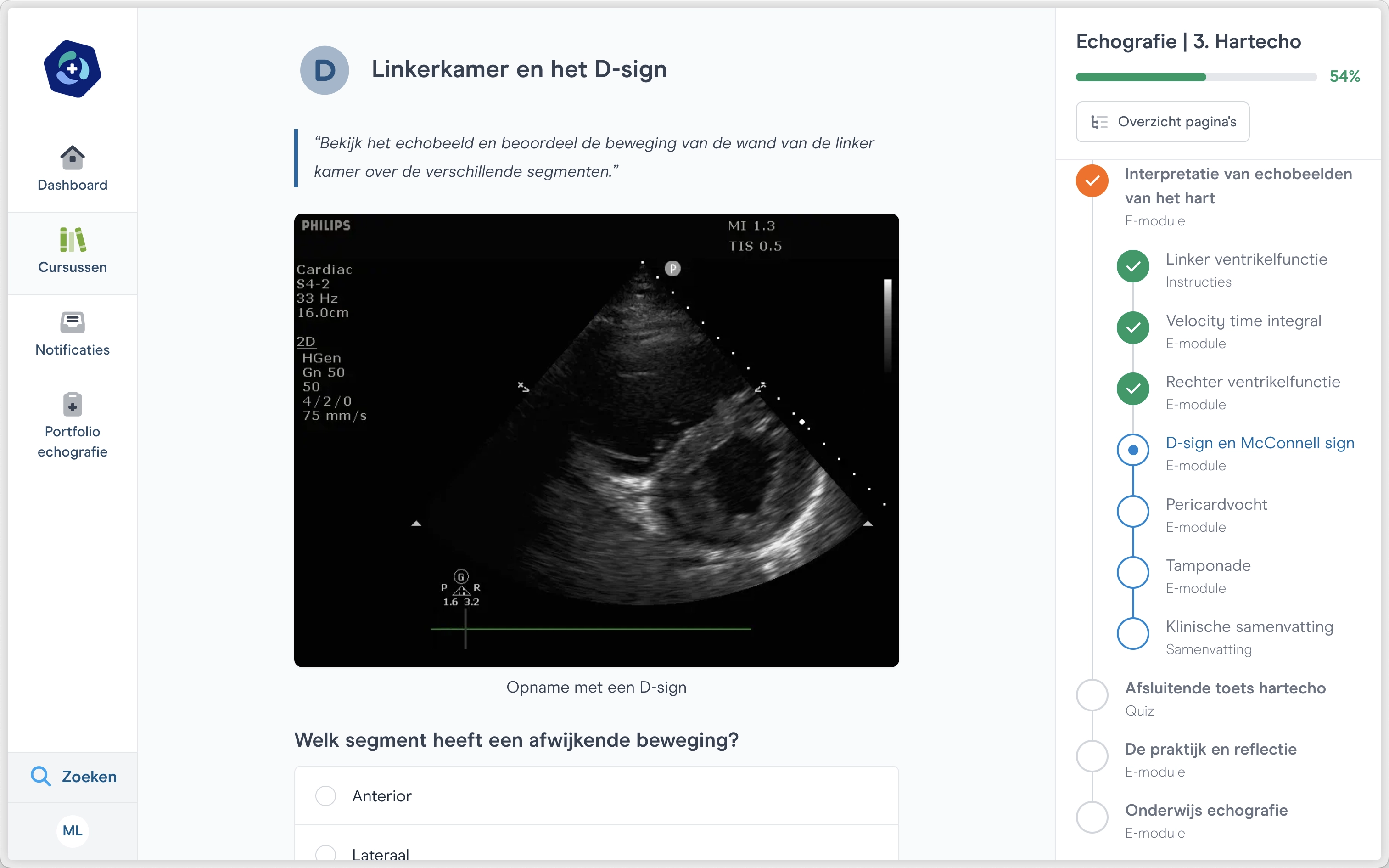 screenshot D-sign hartecho