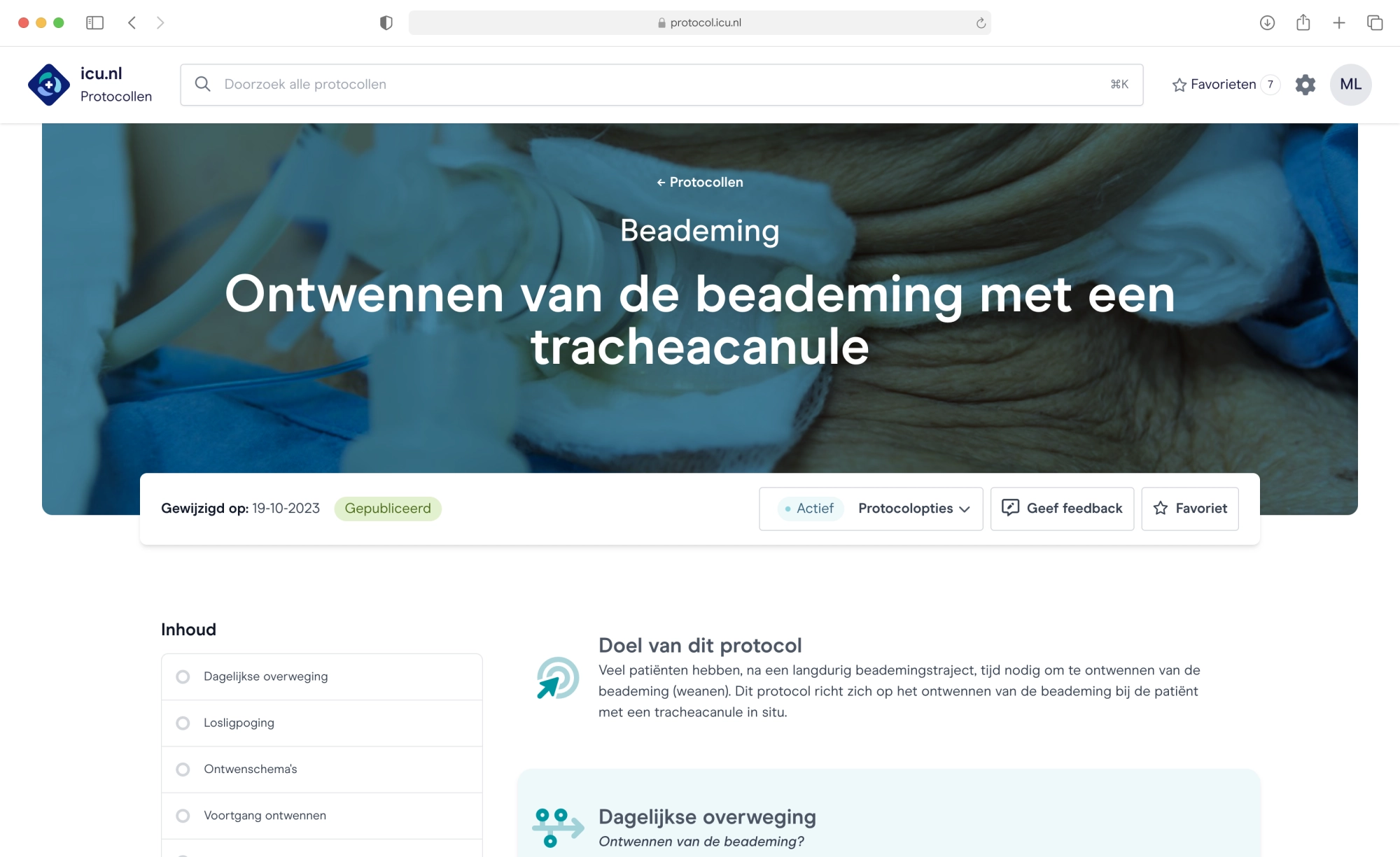 Screenshot van het intensive care protocol over ontwennen of weanen van icu.nl