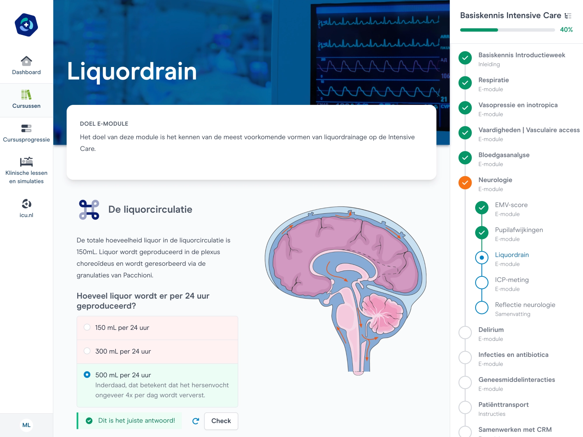 E-learning en cursus over liquor, sedatie en neurologie op de intensive care